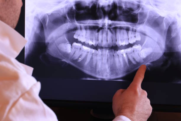 Best Tooth Infection Emergency Dentist  in Loxley, AL