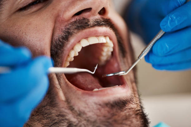 Best Knocked-Out Tooth Emergency  in Loxley, AL