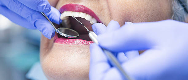 Dentist for Dental Trauma in AL